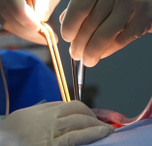 common complications and solutions for 4582161912